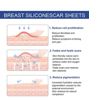 MIXCUT Silicone Scar Sheets for Breast Reduction Surgery - 8 Pack Scar Removal Strips: 4 Areola Soft Strips & 4 Anchor Sheets - Buy Online on GoSupps.com