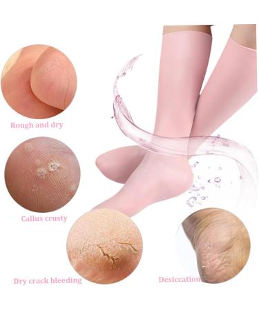 Moisturising Socks 1Pair Anti Slip Elastic Silicone Socks Comfortable Overnight Gel Socks Reusable Foot Moisturiser Socks for Repairing Dry Feet (Pink) Style2 - Buy Online on GoSupps.com