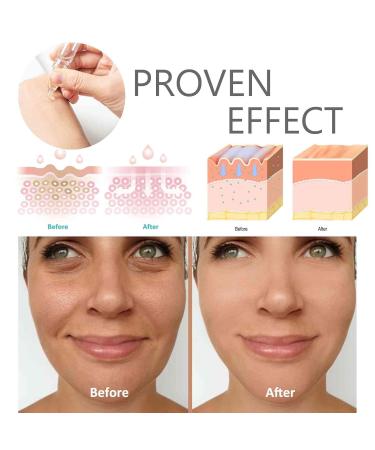 Revitalizing EGF Serum | Advanced Bioactive Peptide Serum for Skin Rejuvenation | 100mg+5ml/pair 7 Pairs - Shop Internationally - Buy Online on GoSupps.com