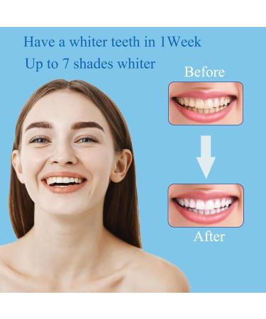 28 Teeth Whitening Strips - Fast Non-Sensitive Bleaching for Coffee Soda & Wine Stains | Shop Internationally - Buy Online on GoSupps.com