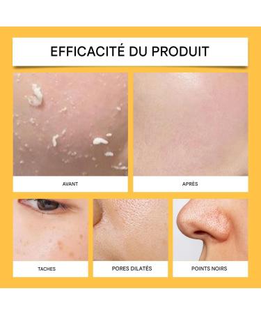 Enveloping Face Mask - 120g Hydrating Enveloping Face Mask Deep Purifying Hydration Firming Facial Treatment for Home Travel Evening - Buy Online on GoSupps.com