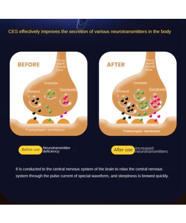 Firstrays Sleep Aid Device Anxiety Relief Items Women Chill Anxiety Relief Anxiety Hand Help Sleeper Therapy Insomnia Device-B White - Buy Online on GoSupps.com