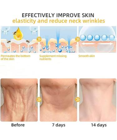  JIAOY Set of 2 firming anti-aging creams with bee venom - Skin care serum - Restores skin elasticity - Natural skin firming serum for everyone - Buy Online on GoSupps.com
