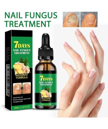  Cymwer Ginger Nail Serum 30ml Natural Growth Oil Strengthener for Fortified Nails Moisturizing and Revitalizing Care - Buy Online on GoSupps.com