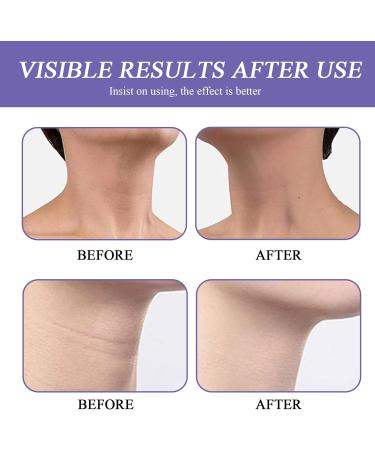 wimony Neck Firming Cream Strengthen Neck Skin Tightening Cream Neck Firming Sagging Skin Aging Skin & Saggy Skin Reduce Wrinkles & Smoothing Neck Fine LIines-Neck&Body - Buy Online on GoSupps.com