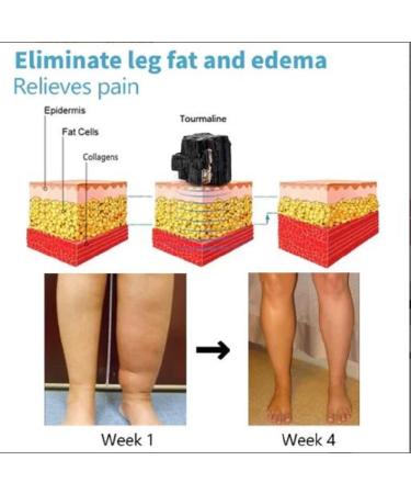 Spayeim Blueshot Turmalin-Ion Magnet Fiber Ice Socks | Body Forming Beige Stretch Socks - Ship Worldwide - Buy Online on GoSupps.com