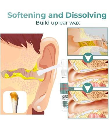 EXQST Anti-Tinnitus & Earwax Removal Spray - Natural Cochlea Cleaner | Relieve Tinnitus & Unclog Ears - 1 Pcs - Buy Online on GoSupps.com
