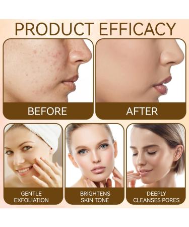 YOFDAL 2 Pieces Black Rice Ampoule White Rice Peeling Serum Black And White Rice As Peeling Rice Ampoule Serum Blackhead Remover Moisturizing For The Face Shine For All Skin Types - Buy Online on GoSupps.com