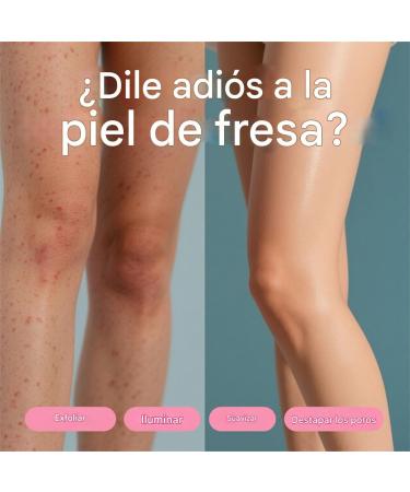 Leg Cream | Moisturizing Leg Care 200ml Advanced Moisturizing Lotion for Skin Types Travel Home Family Women | Family and Friends - Buy Online on GoSupps.com