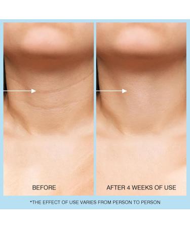 Retinol Neck Cream - Hyaluronic Acid & Caffeine Enriched Neck Firming Cream | Anti-Aging 3-in-1 Moisturizing Cream to Minimize Fine Lines Dullness & Sagging Skin for Neck Chest & Face (50ml/1.7oz) - Buy Online on GoSupps.com
