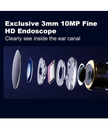 Smart Visible Ear Cleaner | Ear Wax Removal Tool with 10MP HD 360 Degree Wide Angle Ear Scope | Earwax Remover (White) - Buy Online on GoSupps.com