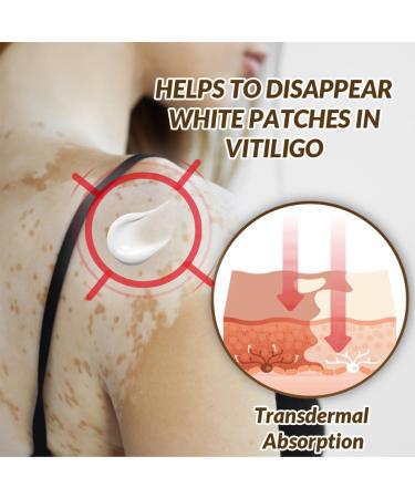 OIXYEY OIXEY 1 piece whitening cream natural plant extracts gently and effectively reduces white spots improves pigmentation suitable for all skin types 20 GA - Buy Online on GoSupps.com