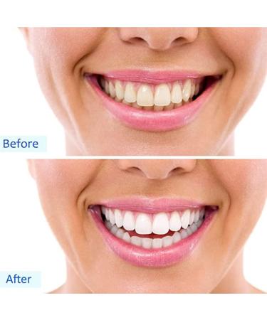 Xzlzmd Pebbles Dentures - Cosmetic Upper & Lower Veneers for Immediate Repair of Cracked/Missing Teeth - 6 Pairs of Prosthesis - Buy Online on GoSupps.com