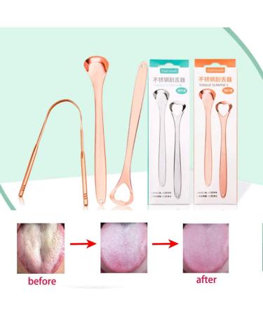Stainless Steel Tongue Cleaner - Rustproof 3 Pack for Adults & Kids | Reduce Oral Problems - Buy Online on GoSupps.com