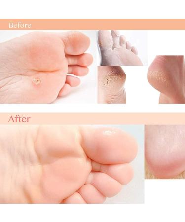BaySerry Ginger Spatholobus Foot Bath Soak Powder - Promotes Blood Circulation, Dispels Dampness, Healthy Feet - 5PCS x 100g - Buy Online on GoSupps.com