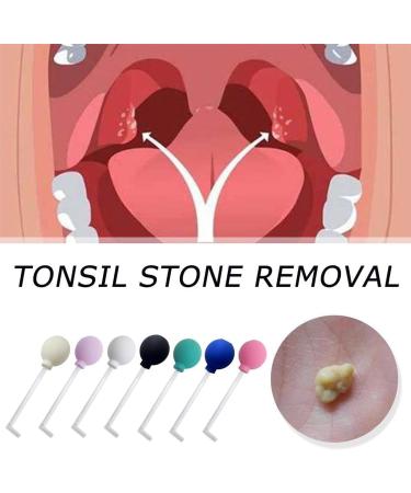Black Tonsil Stone Removal Kit & Vacuum - Manual Tool for Adults - Buy Online on GoSupps.com