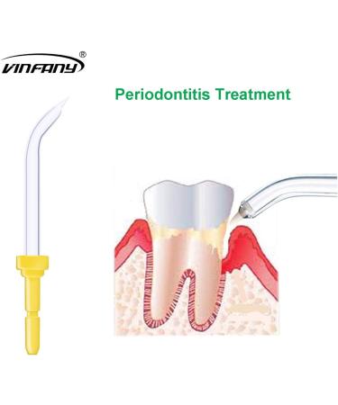 Dental Water Jet Pik Pocket Replacement Tips - 2pcs for Waterpik Oral Irrigator (Pocket Tips) - Compatible with Wp-100, Wp-450, Wp-250, Wp-300, Wp-660, Wp-900 - Buy Online on GoSupps.com