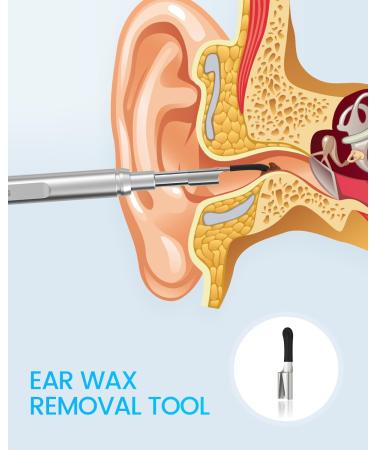 Teslong Otoscope HD Ear Wax Remover - Ultra-Thin Wireless Endoscope for iPhone & Android | NTE100i-EU - Buy Online on GoSupps.com