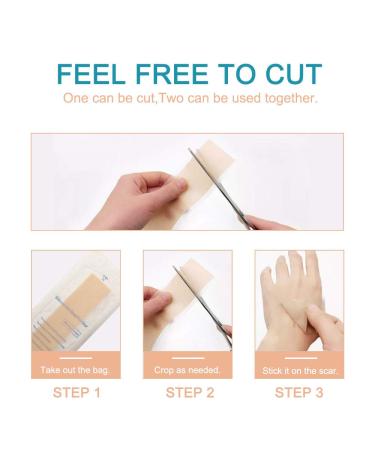 Silicone Scar Sheets - Reusable Treatment Strips for Keloids, C-Section, Surgery, Burns, and Acne - 4 Sheets - 5.9x1.6 - Best for Scar Reduction - Buy Online on GoSupps.com