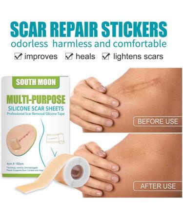 Silicone Scar Gel Strip - Efficient Scar Treatment for Surgery, Acne & Trauma - 4 * 150cm - Buy Online on GoSupps.com