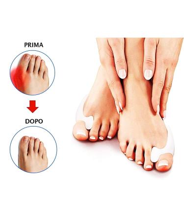 Hallux Valgus Corrector - Gel Medical Silicone - Anti-Chafing Pain Relief Separator - 6 Beige Pieces - Best Gift Idea - Buy Online on GoSupps.com