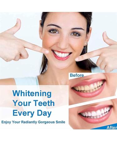 Body Accel Whitening Toothpaste with Niacinamide Dazzling White Remove & Lighten (1PC 1g) - International Shipping Available - Buy Online on GoSupps.com