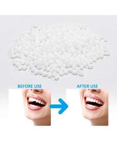 Temporary Tooth Restoration Beads - 20g | Dental Floss Sticks & Filler for Missing Teeth | Tooth Replacement & Repair Solutions - Buy Online on GoSupps.com