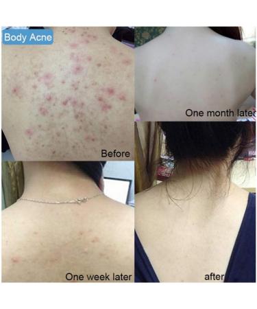 Hocossy Mite Remove Soap Rich In Sea Salt Goat Facial Soap for Pimple Pores Repair Nourish Cleansing Personal Skin Care Product - Buy Online on GoSupps.com