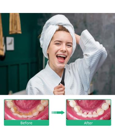 Electric Dental Calculus Remover - Plaque & Tartar Stain Removal Tool with LED Light | Sonic Tooth Cleaner Scraper Kit - USB Rechargeable | 3 Adjustable Modes - Black - Buy Online on GoSupps.com