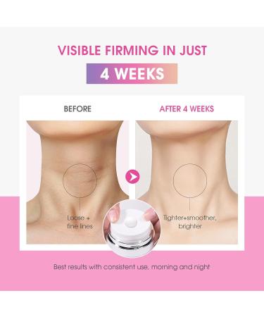 Neck Firming Cream with Retinol Collagen & Hyaluronic Acid - Tighten & Lift Crepey Skin Improve Wrinkle Appearance Even Skin Tone - 1.7 Fl Oz Moisturizer for Face & Neck - Buy Online on GoSupps.com