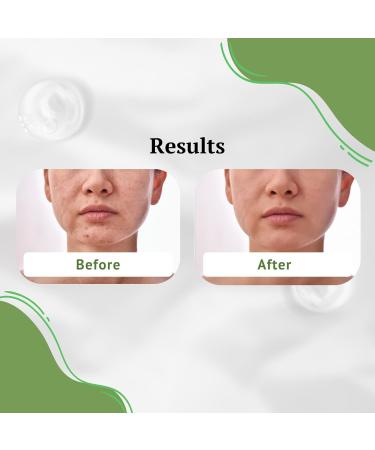Aloe Vera & Vitamin C Serum - Brightening Hydrating 1 oz - International Shipping Available - Buy Online on GoSupps.com