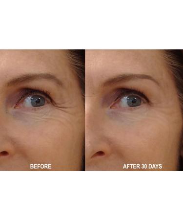 DNA Code -No Needle Alternative-Pure Argireline Peptides Wrinkle Reduce Serum+ Matrixyl 3000+Hyaluronic Acid - Buy Online on GoSupps.com