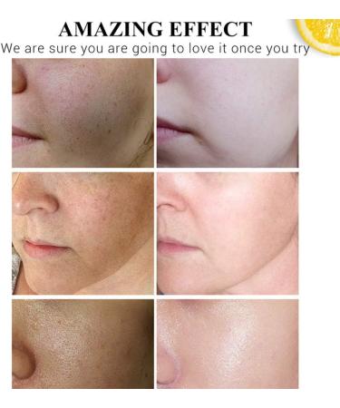 DISAAR BEAUTY Vitamin C Hyaluronic Acid Anti-Aging Moisturizing Facial Serum Deep Nourishment Anti-Acne Improve Skin 30ML - Buy Online on GoSupps.com