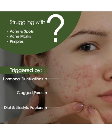 Eladi & Neem Face Wash - Clear & Acne-Free Skin | Oil Control Blemish Reduction & Hydration | 50ml - International Shipping Available - Buy Online on GoSupps.com