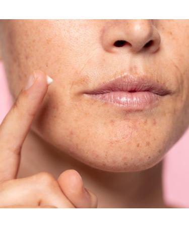  Freshly Freshly Cosmetics Lotus Radiance Darkspot Treatment Depigmenting Cream 50 ml - Buy Online on GoSupps.com