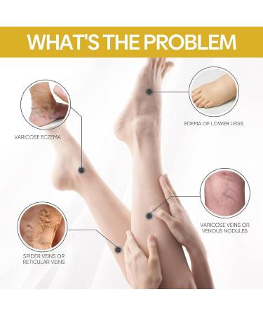 2024 New Bee Venom Varicose & Spider Veins Relief Cream for Legs Natural Varicose & Spider Veins Improve the Look of the Legs and Blood Circulation Tired and Heavy Legs Relief 60g/2.11fl.oz (2 Jars) - Buy Online on GoSupps.com