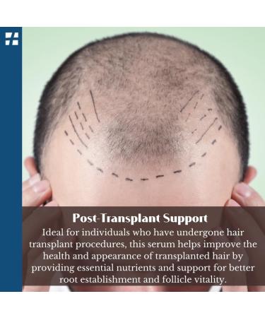 Turkeyana Plus Clinical Hair Repair Serum - Enhance Hair Regrowth & Revitalize Scalps | Natural Vegan Plant Stem Cells Biotin & Keratin - 1.69 fl Oz - Buy Online on GoSupps.com