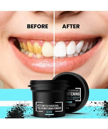 Naturals Activated Charcoal Teeth Whitening Powder - for Teeth Whitening Stain Remover Freshens Breath - with Activated Charcoal Turmeric & Clove Powder - 35g (Fluoride Free) - Buy Online on GoSupps.com