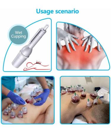 5 Pin Lancing Device Blood Lancet Pen + 200pcs Lancet - Steril Cupping Therapy Set - Buy Online on GoSupps.com