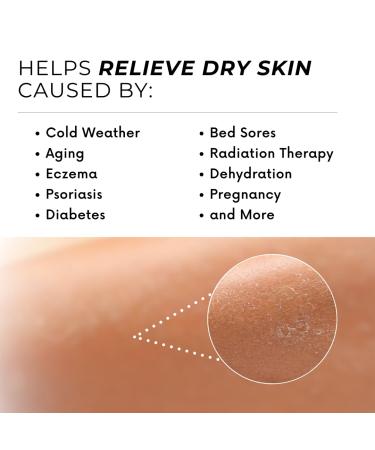 Activated Ghee Body Oil & Balm - Premium Shea Moisturizer for Extra Dry Skin | Nourishing Ghee Shea Butter & Coconut Oil | After Sun Care (8 oz - Buy Online on GoSupps.com