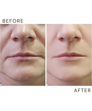 Vitali-Chi - Anti Aging Face Cream with Vitamins A E C & Pro-Vitamin B5 | for Moisturised Anti Wrinkle & Glowing skin - 50ml - Buy Online on GoSupps.com