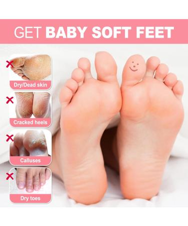 Foot Peel Mask 3 Pack JVR Lactic Acid Foot Mask Foot Exfoliating Socks Foot Care for Callus Remove Repair Cracked Heel & Dead Dry & Hard Skin Baby Soft Smooth Touch Feet (Rose) - Buy Online on GoSupps.com