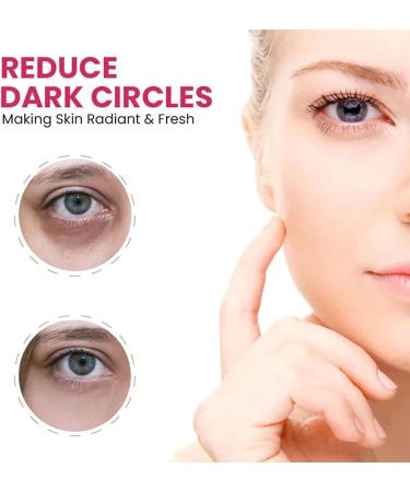 Anti-Eye Bag Cream - 15g | Reduces Tear Bags & Dark Circles | Hyaluronic Acid Eye Roller for Puffiness Relief - Buy Online on GoSupps.com