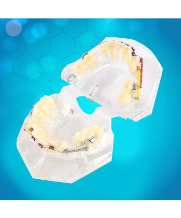 Orthodontic Model PVC Resin for Malocclusion Treatment - Adult & Child Dental Education Model with Wire Chain - Buy Online on GoSupps.com