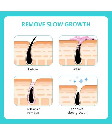 Skinetic Peach Fuzz Hair Removal Cream 100g - Gentle Hair Remover for Facial Mustache, Lip, and Fine Hair - Buy Online on GoSupps.com