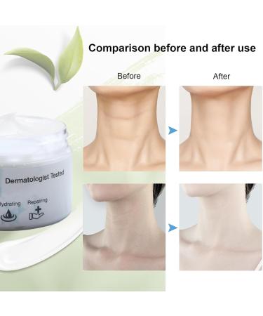 Firming Cream - Face and Neck Lift Moisturizer and Anti-Aging Cream with Retinol Collagen & Vitamin E for Smooth Wrinkle Fine Lines Hydrating and Restore Skin Elasticity - Buy Online on GoSupps.com