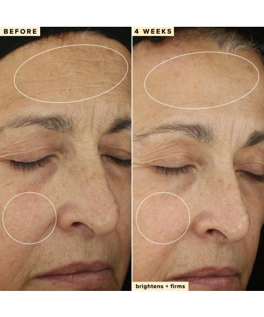 Farmacy Vitamin C & Retinol Serum Bundle - Waterless Vitamin C Face Serum & 1% Vitamin A Resurfacing Retinol Serum - Buy Online on GoSupps.com