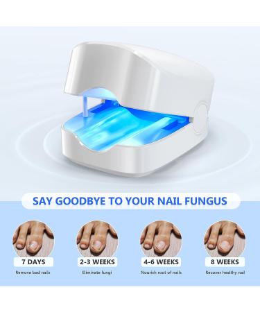 Anyork Toenail Fungus Treatment - Automatic Nail Fungal Cleaning Device - Buy Online on GoSupps.com
