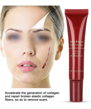 Scar Removal Cream | Accelerate Wound Healing, Repair Elastic Collagen Fibers | Burns & Scars Treatment - Buy Online on GoSupps.com