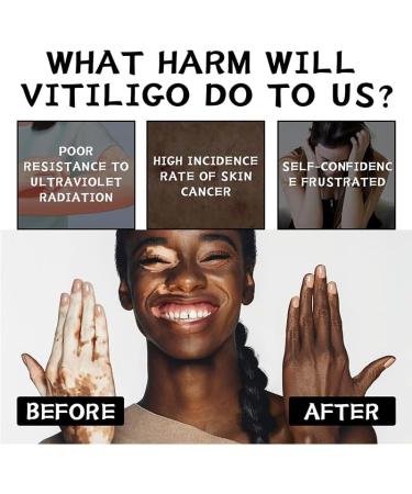 (Two Packs)Psoralea Corylifolia Skin Revitalizing Balm - External Use Tone Repair Cream for Uneven and White Spot Care - Buy Online on GoSupps.com